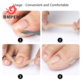  Bmpeic 8   20 Miếng Dán Chỉnh Sửa Móng Tay Cây Trồng Móng Chân Corrector Miếng Dán Paronychia Điều Trị Phục Hồi Corrector Dụng Cụ Làm Móng Chân Mới 