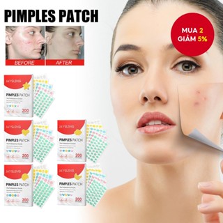 200 CÁI + 180 CÁI Nhãn dán điều Hỗ trợ giảm mụn đầy màu sắc Loại bỏ mụn trứng cá vô hình Miếng dán chăm sóc da