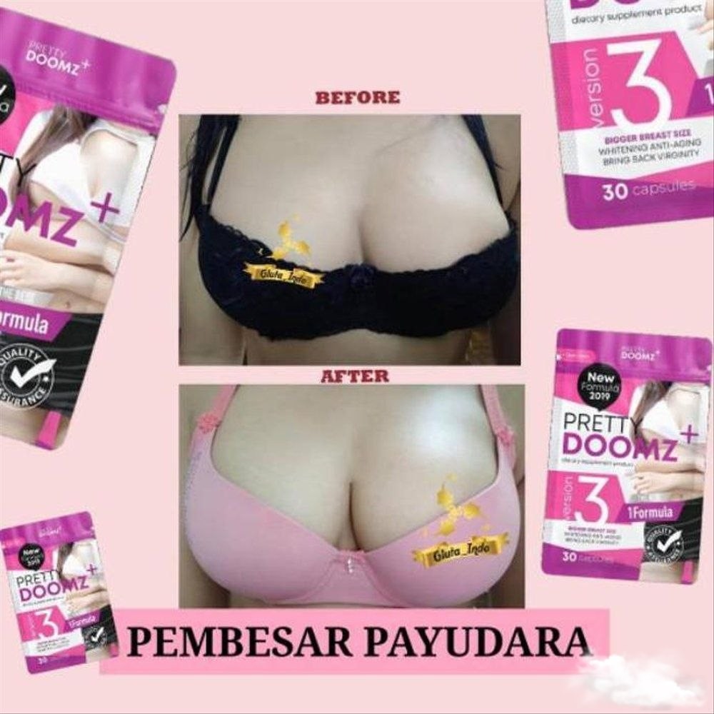 Patty Doomz Plus by Precious Skin Thái Lan nở ngực, nâng mông, trắng da nội tiết tố