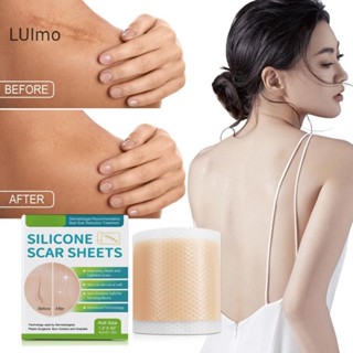  Luimo 150   300 Cm Silicone Gel Scar Sheet Miếng Dán Điều Trị Loại Bỏ Băng Mụn Chấn Thương Đốt Sẹo Bao Da Sửa Chữa Da Phần Làm Đẹp Tai SBS 