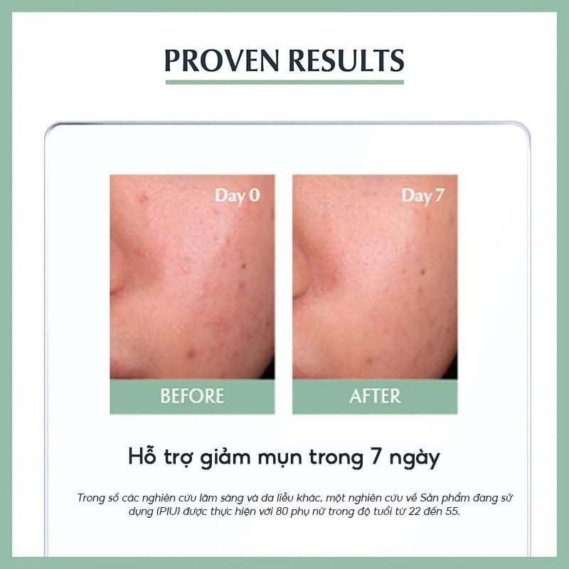 Tinh Chất Eucerin Dưỡng Cho Da Mụn Pro Acne SOS Serum 40ml