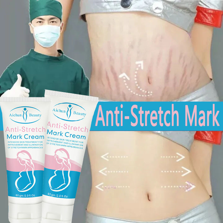 (Xóa rạn da nhanh chóng trong 7 ngày) Kem xoá rạn da sau sinh, làm mờ vết thâm, sáng đều màu da, cải thiện sẹo lâu năm