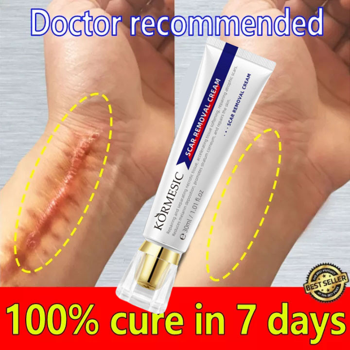 Kem XóA SẹO ThâM SẹO PhẫU ThuậT LồI LõM Rỗ Mờ ThâM MụN RạN Da NgừA MụN Kem Mờ SẹO LâU NăM Kem LàM Mờ SẹO ThâM
