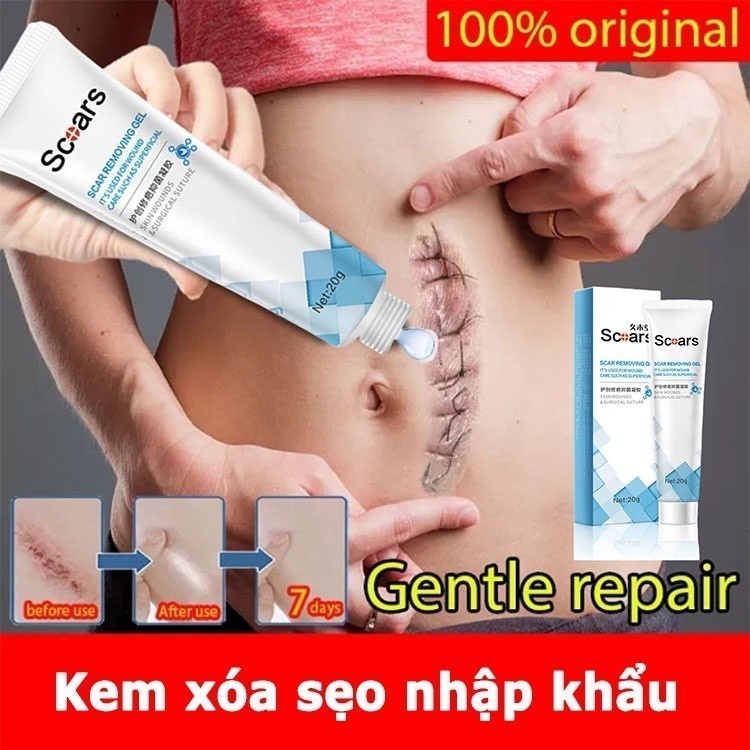 Kem Xóa Sẹo 20g Loại Bỏ Hiệu Quả Các Vết Sẹo Cũ Sẹo Sẹo Phẫu Thuật, Cũ Sẹo Bỏ Sẹo Mụn Trứng Cá Vết Sẹo Muỗi Đốt