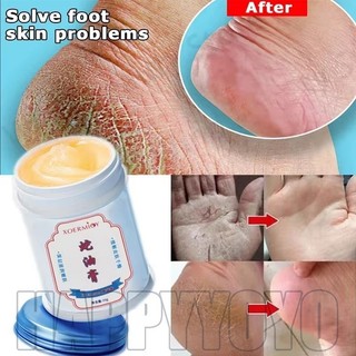 30g Herbal Anti Crack Foot Cream- Loại bỏ tế bào da chết Làm mềm da Sản phẩm sửa chữa dưỡng ẩm- Kem làm đẹp vết nứt gót chân