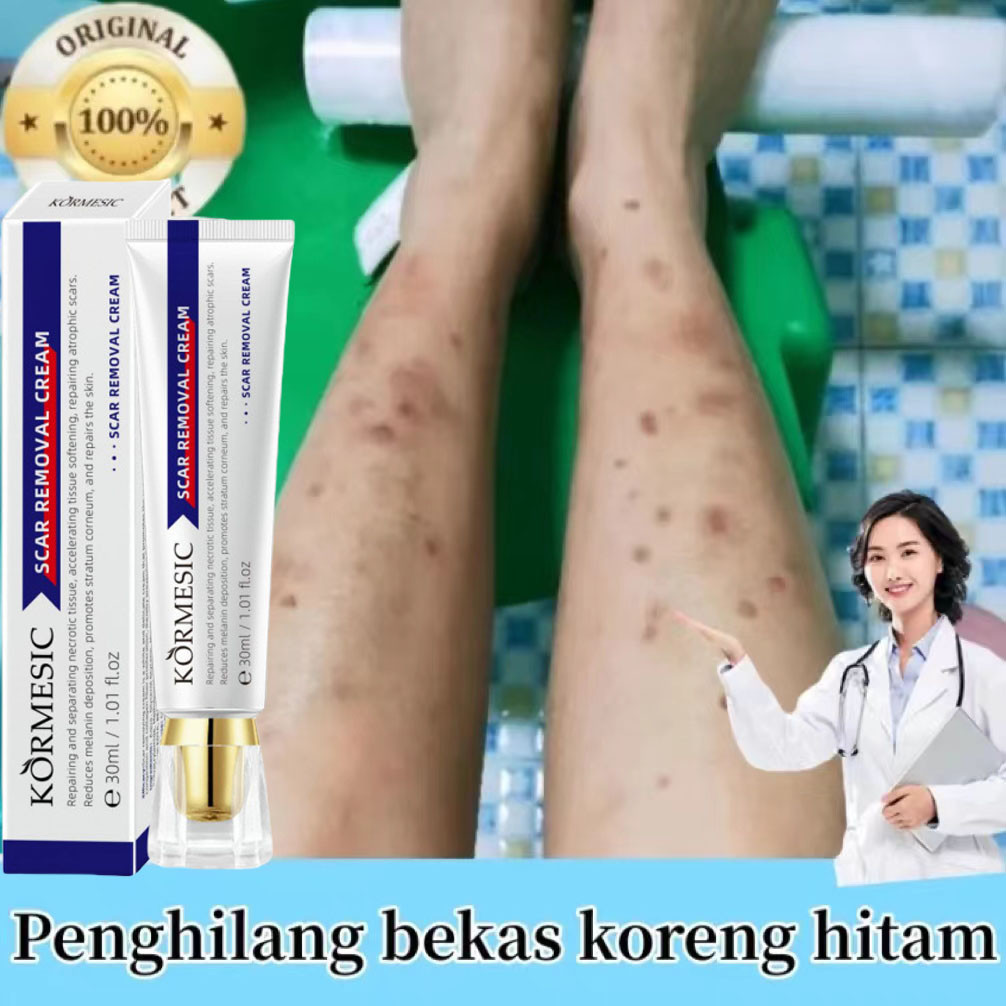 Kem mờ sẹo mờ thâm sẹo lồi sẹo lõm sẹo do mụn và giảm rạn da hiệu quả 30ml nhanh chóng làm mờ sẹo lồi sẹo lõm