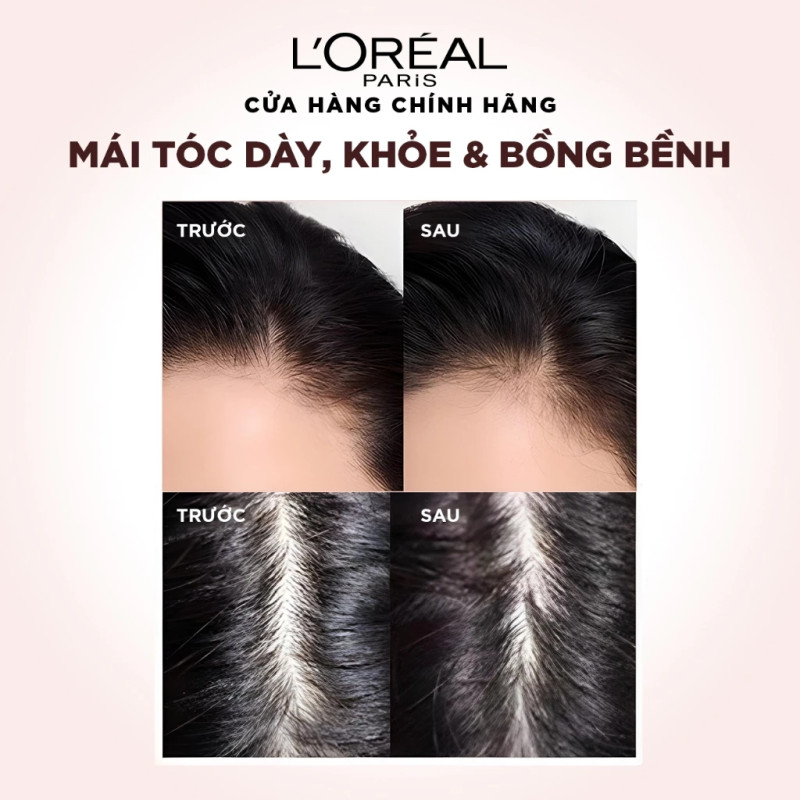 Bộ đôi dầu gội xả ngăn ngừa & giảm gãy rụng tóc, giúp tóc chắc khỏe hơn L’oreal Paris Elseve Full Resist 440ml | BigBuy360 - bigbuy360.vn