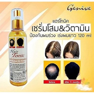 Xịt kích thích mọc tóc, chống rụng tóc genive thái lan