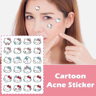 Hoạt Hình Dễ Thương Động Vật Mụn Miếng Dán Hydrocolloid Hồng Mụn Bé Gái Miếng Dán Da Dụng Cụ Chăm Sóc Miếng Dán Sử Dụng W6c6