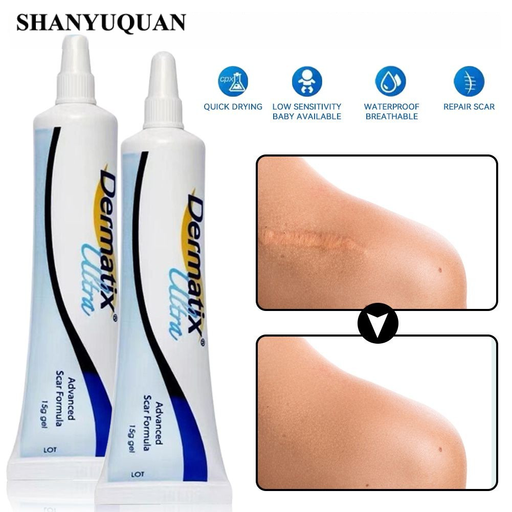 Dermatix Ultra Gel 15g Công Thức Sẹo Loại Bỏ Loại Bỏ Vết Rạn Da Làm Trắng Da Hiệu Quả Làm Mịn Kem Thành Phần An Toàn wine01
