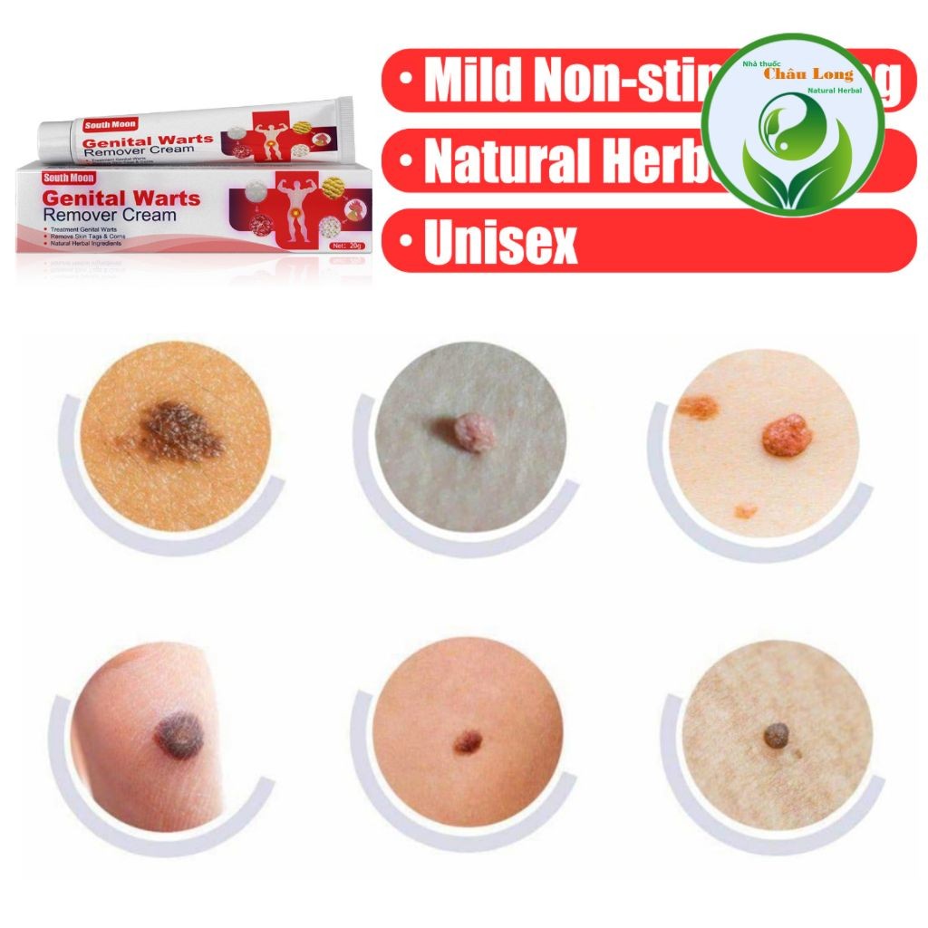 Kem South Moon Bôi Ngứa Vùng Sinh Dục, Mụn Sinh Dục, Sùi Mào Gà nam nữ, thành phần thảo dược Herbal Cream