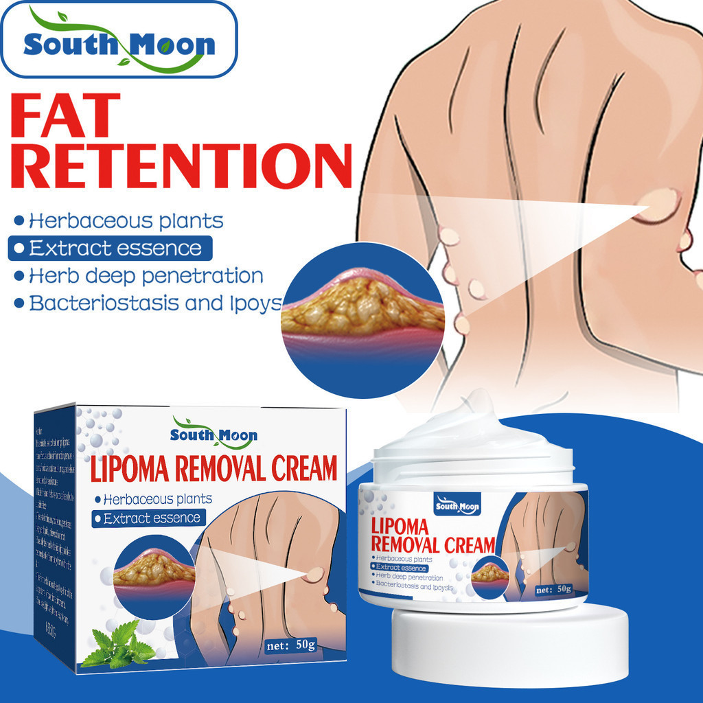 Kem Mềm U Mỡ, Xử Lý Hạt Mỡ, Loại Bỏ Nhiều Khối U Mỡ Tuyến Giáp Và U Mỡ Dưới Da 50g