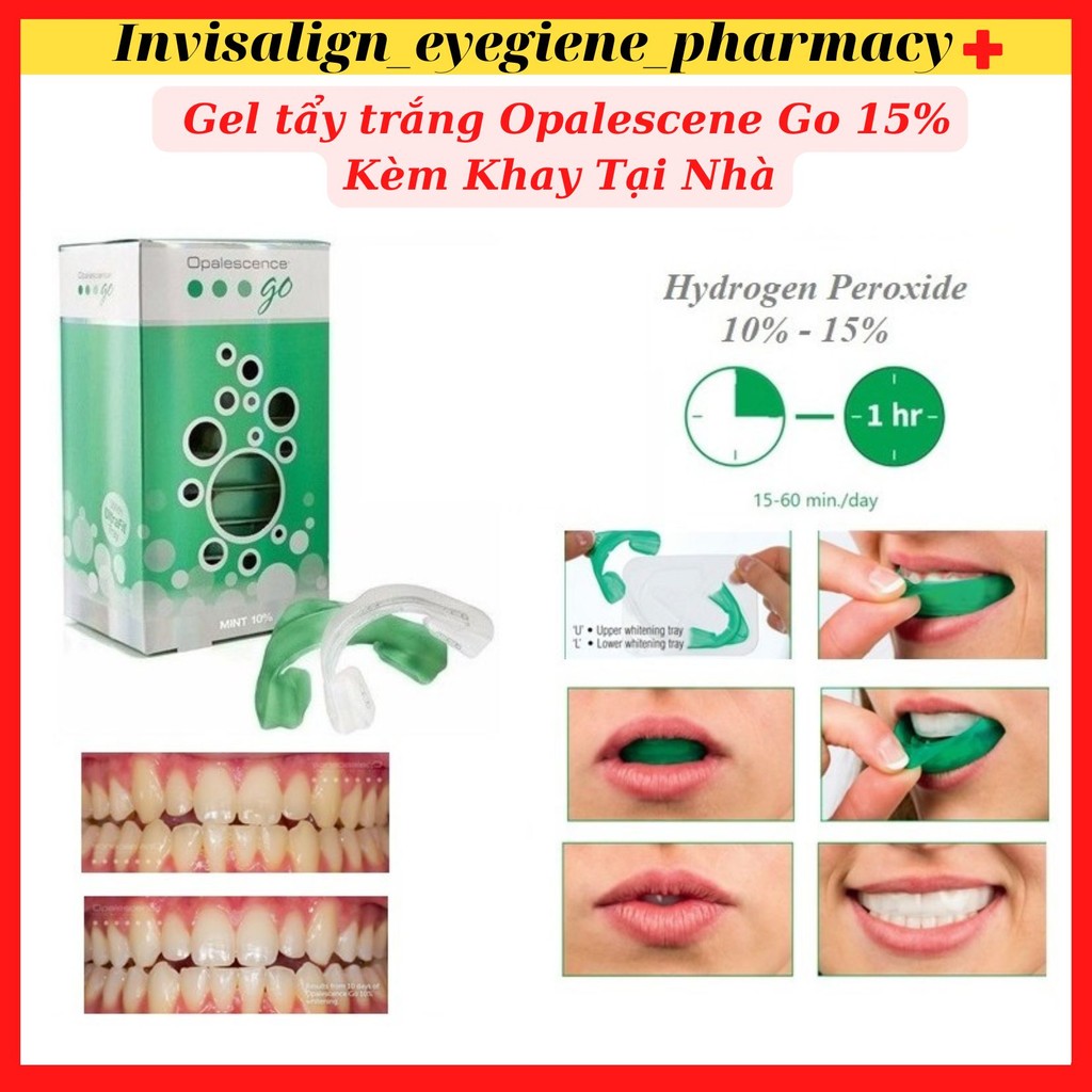Gel tẩy trắng Opalescence Go kèm Khay tẩy trắng răng có sẵn dùng tại nhà An Toàn, Hiệu Quả Hãng Ultr
