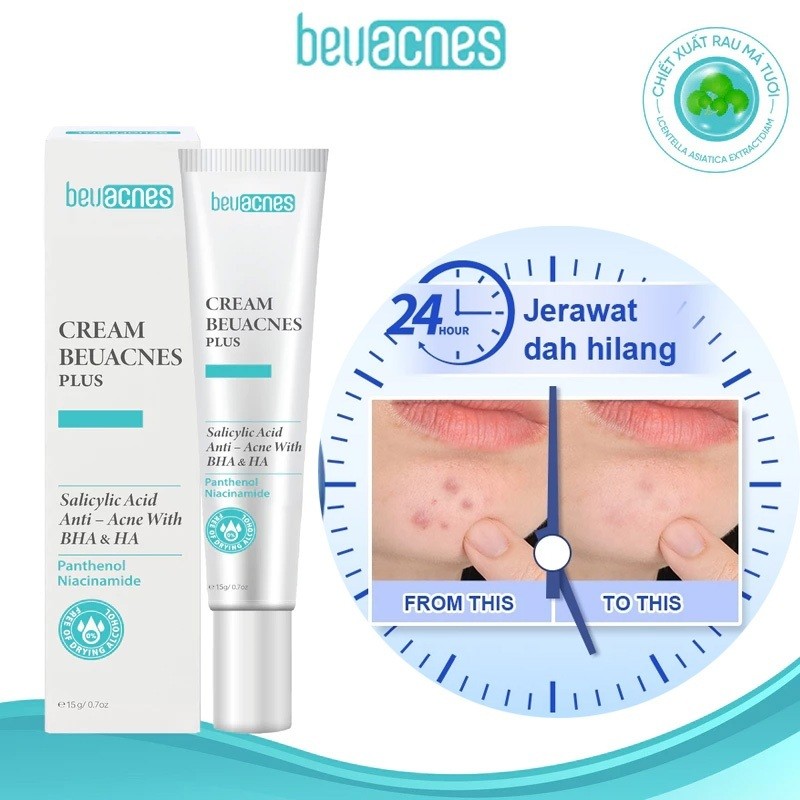 Gel giảm mụn BEUACNES giảm mụn trứng cá, chiết xuất rau má, hỗ trợ mờ thâm mụn nhanh trong 24h