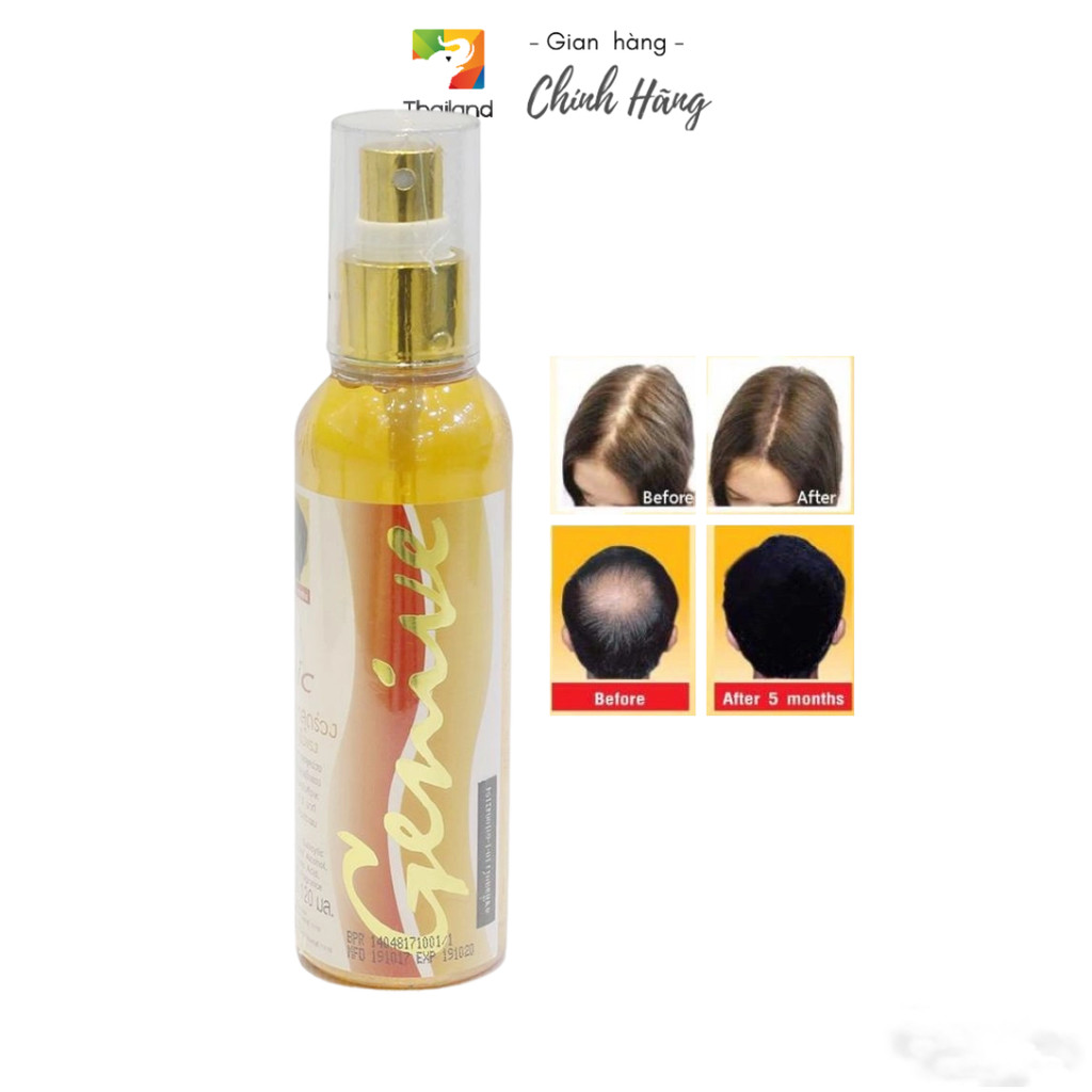 Xịt kích thích mọc tóc, chống rụng tóc genive thái lan