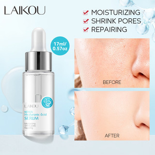 Laikou serum hyaluronic acid Dưỡng Ẩm Thu Nhỏ Lỗ Chân Lông Phục Hồi Da Nhạy Cảm 17ml