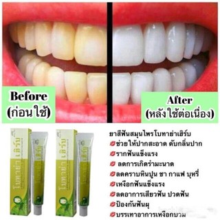 Kem đánh răņg thảo ḋược Botaya Herb Natural Toothpaste