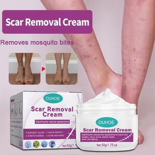 Kem loại bỏ sẹo cũ cho chân, sửa chữa và làm mờ sẹo
