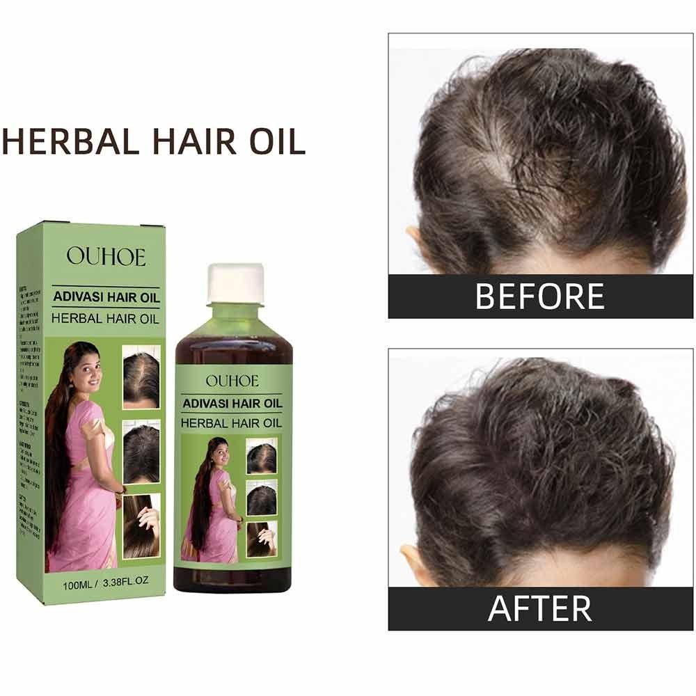 OUHOE Herbal Hair Strengthening Oil 100ml Hair Accessories
