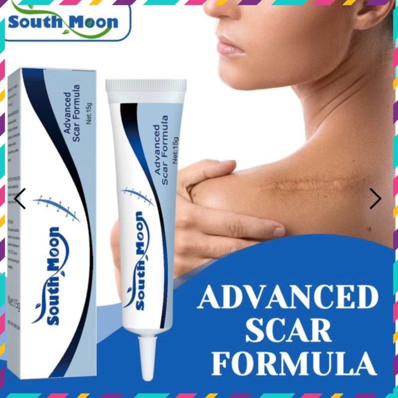 Kem thoa mờ sẹo South moon US - QUEENSHOP68