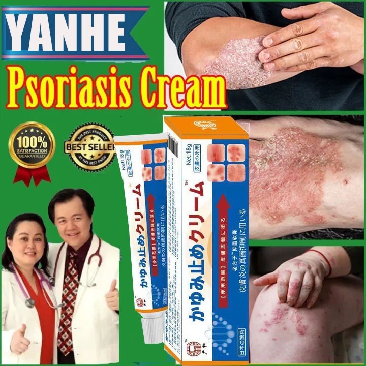 Kem Nhật Bản Bôi Nấm Kem Bôi Hắc Lào Thảo Dược, Phát Ban Tổ Đĩa Vảy Nến, Mề Đay Chính Hãng