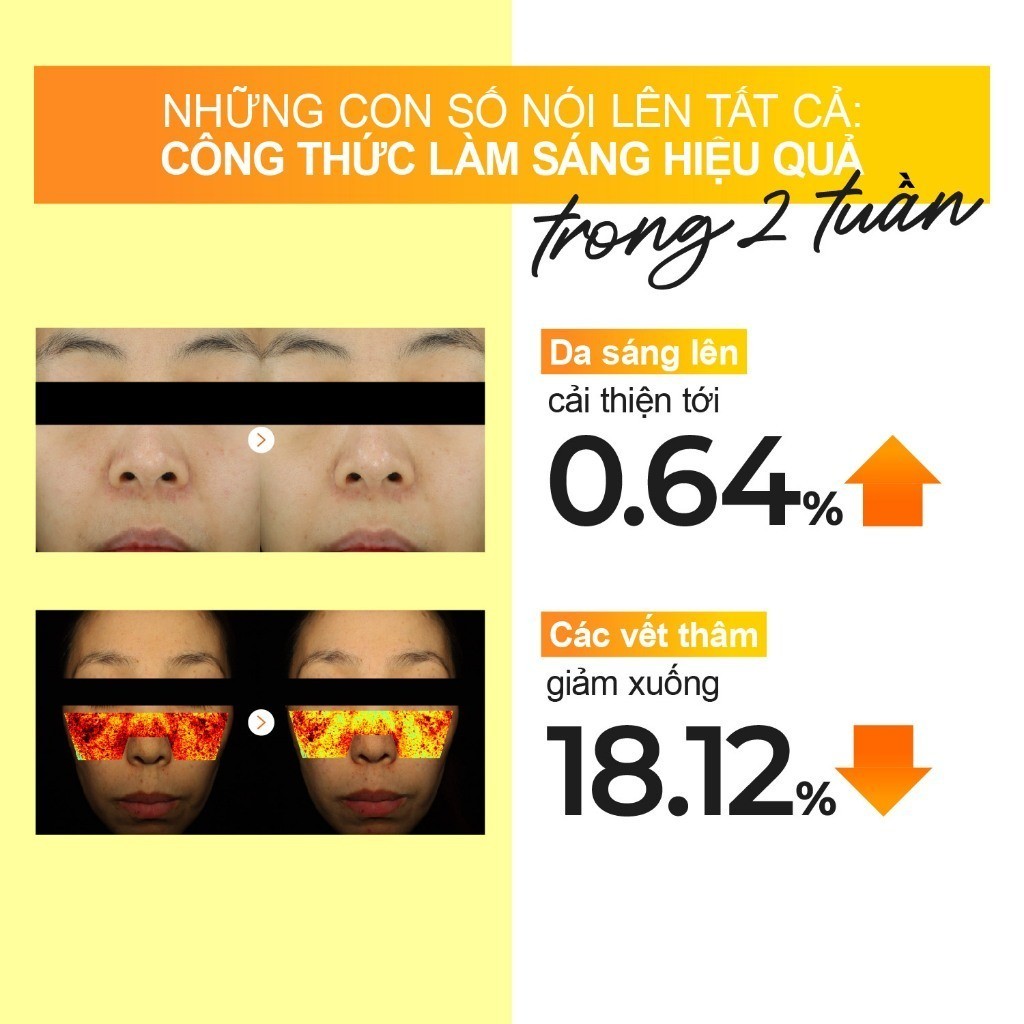 Nước Hoa Hồng Dưỡng Sáng Da Numbuzin No.5+ Vitamin Boosting Essential Toner 200ml