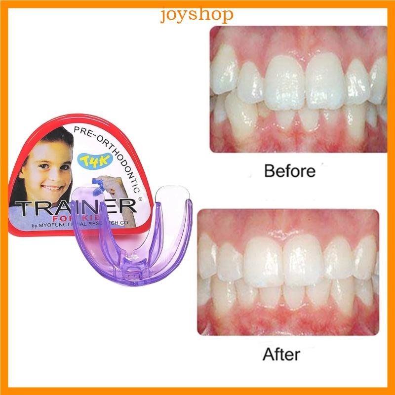 Niềng răng chỉnh nha Niềng răng trẻ em Niềng răng tức thì Huấn luyện viên căn chỉnh răng