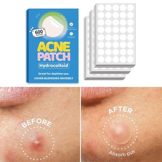  720 Chiếc Hình Bầu Dục Dung Tích Lớn Mụn Miếng Dán Trong Suốt Tròn PE Hydrocolloid Acne Patch Có Túi M2B4 