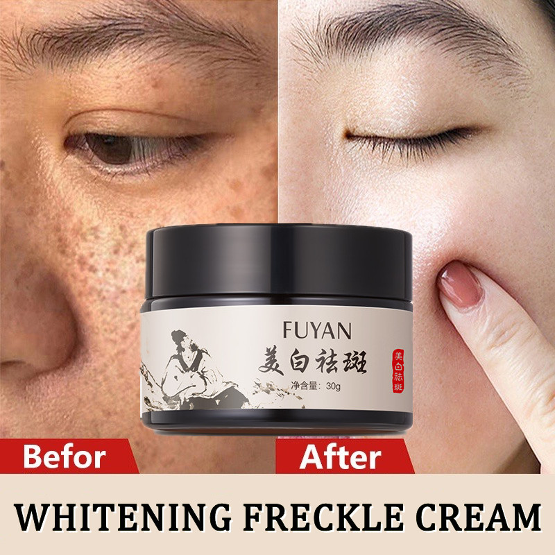 Kem làm trắng da FUYAN 30g Giảm màu Điểm tàn nhang Nám nắng Điểm mang thai