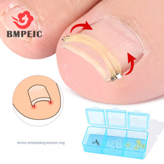  Bmpeic Ingrown Móng Chân Corrector Phục Hồi Nhúng Ngón Chân Điều Trị Móng Tay Chuyên Nghiệp Chỉnh Sửa Chân Miếng Dán Công Cụ Chăm Sóc Mới 