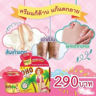 Kem thâm rạn da Nitcher Oho Soft Cream White 100gr Thái Lan