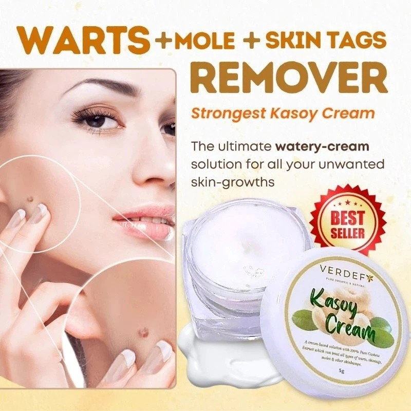 KEM KASOY MẠNH MẼ HIỆU QUẢ REMOVER OF WARTS MOLE SKIN TAG SYROMEMA & MILIA của Verdefy