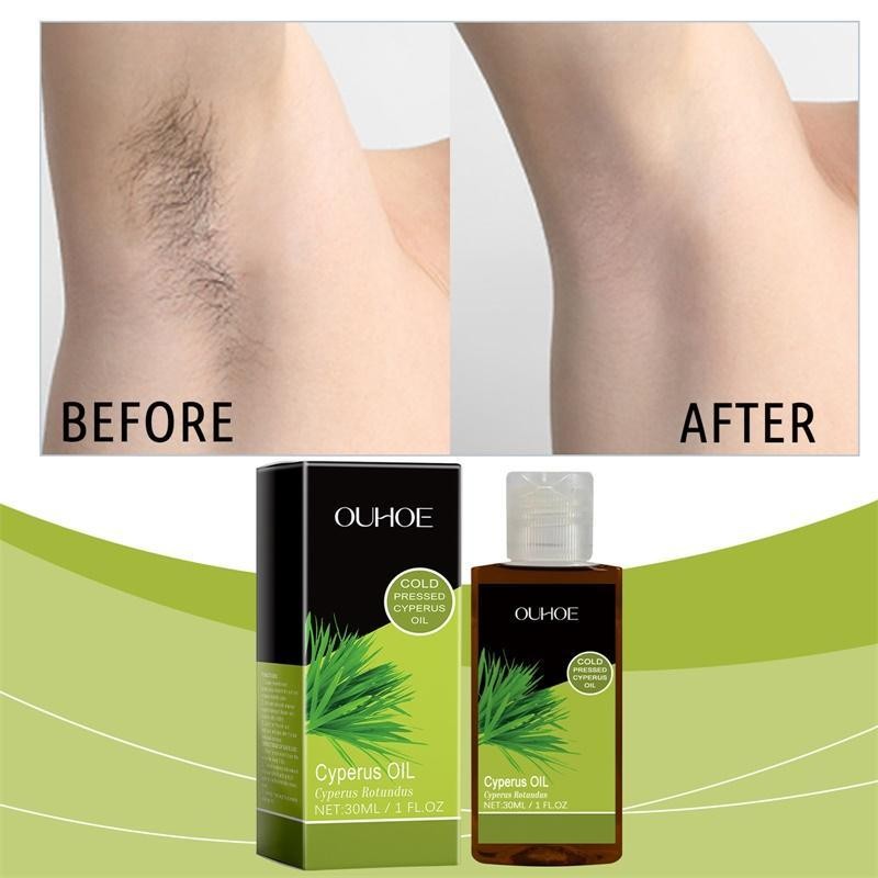 Dầu Cyprus Tẩy Lông Dầu Tẩy Lông Tự Nhiên 30ml Dầu Cyprus Rotundus để Tẩy Lông lambnph