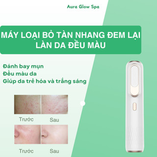  Máy trị mụn công nghệ ion hóa loại bỏ thâm sạch lỗ chân lông nâng cơ đàn hồi da CSSD162 Auraglowspa 