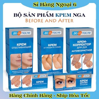 [DATE MỚI] Kem bôi chống nứt gót chân, giảm đồi mồi, nhăn tay Kpem Nga Before and After