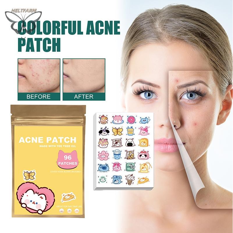 VÀNG 96 Chiếc Miếng Dán Mụn Hoạt Hình Mèo Hình Hỗ trợ giảm mụn Miếng Dán Vô Hình Mụn Loại Bỏ Mụn Miế