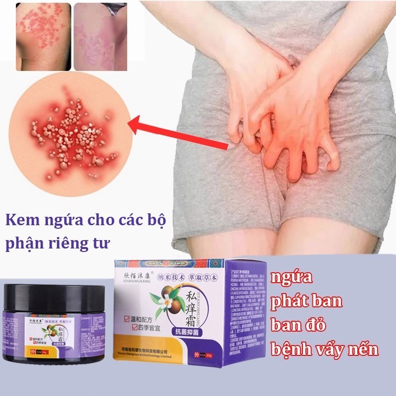 Kem Bôi Da Hắc Lào 30gkem Bôi Ngứa Kem Bôi Nấm Ngứa Nhật Bản Kem Bôi Ngứa Da Bôi Hắc Lào Nấm Ngứa Ke