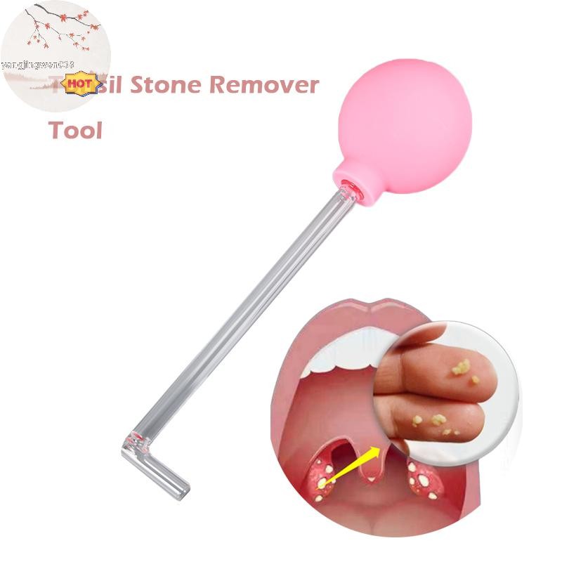 YANGWEN Tonsil Stone Remover Tool Manual Style Remover Mouth Cleaning Care Tool Ear Wax Tonsil Stone