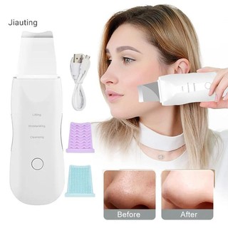 Jiauting Siêu Âm Máy Chà Da Rung Mặt Thìa Tẩy Mụn Đầu Đen Xẻng Làm Sạch Cavitation Lột Mặt Leifg Dụng Cụ Chăm Sóc Da Mgn