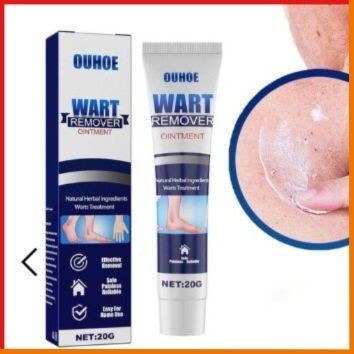 OUHOE WART REMOVER Kem Tẩy M.ụn Thịt, Ruồi Chính Hãng Nhập Khẩu USA - hatastore