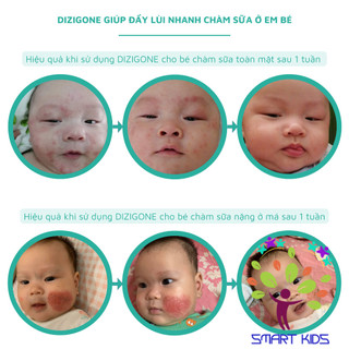 Dung dịch kháng khuẩn DIZIGONE