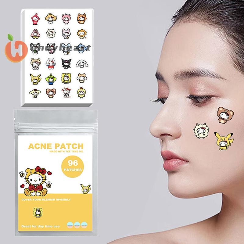 < Honeyheart > 96 Miếng Dán Mụn Hoạt Hình Sanrio HelloKitty Hình Mụn Miếng Dán Vô Hình Mụn Loại Bỏ M