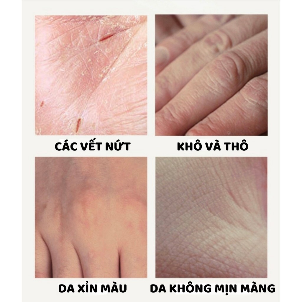 Kem dưỡng da tay JINGCHUNMIMI - Kem dưỡng tay JINGCHUNMIMI mờ nhăn, dưỡng ẩm,  dưỡng trắng, mềm da tay - XAVIA