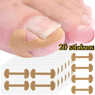  Nhãn dán chỉnh sửa móng chân mọc ngược - Dụng cụ làm móng chân tự dính - Nhãn dán điều trị Paronychia - Nhãn dán chăm sóc đàn hồi - Chỉnh sửa điều trị móng tay - Miếng dán chỉnh nha chăm sóc móng tay 