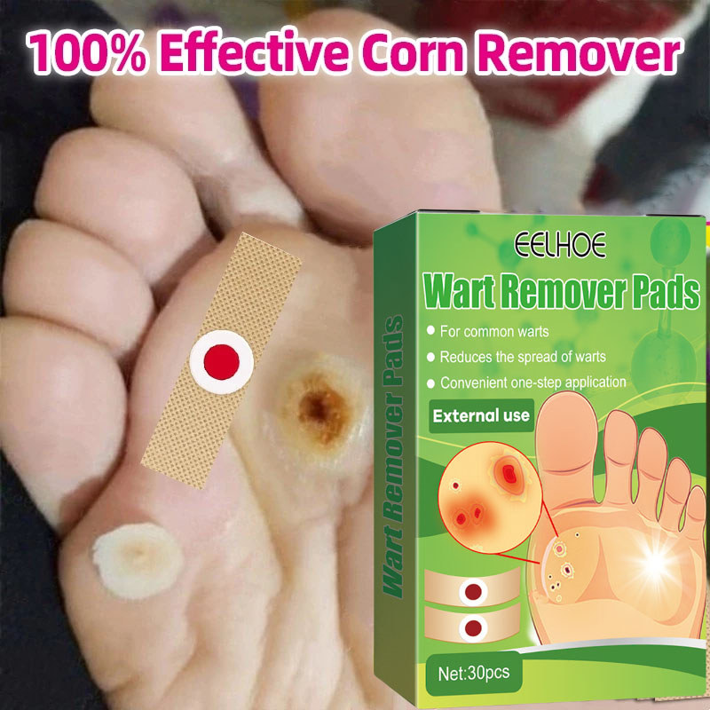 Miếng dán plasters hỗ trợ xử lý mụn cóc miếng dán mụn cóc chính hãng