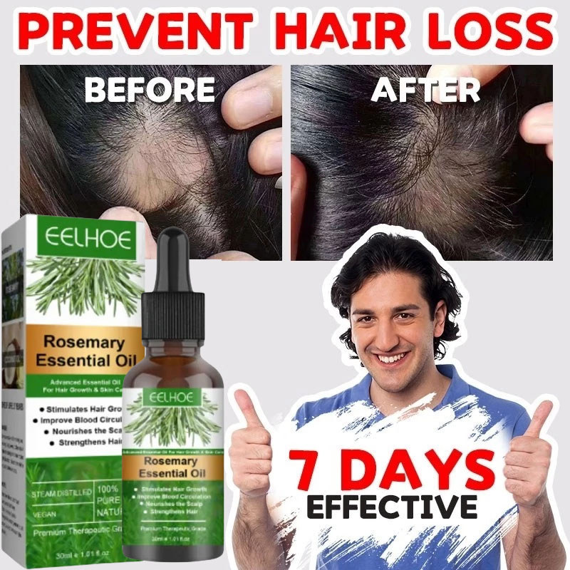 Thuốc mọc tóc serum mọc tóc tinh chất mọc tóc dưỡng tóc chống rụng tóc kích mọc tóc nhanh