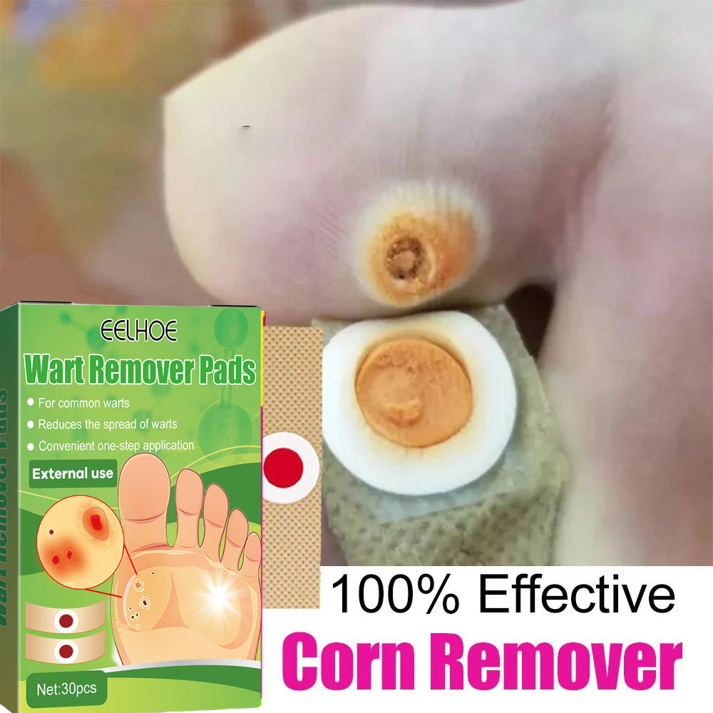 Miếng dán plasters hỗ trợ xử lý mụn cóc, mắt cá chân nhanh gọn tại nhà an toàn, miếng dán mụn cóc ch