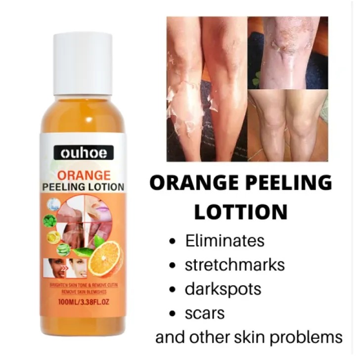 Peel da mặt vi- tẩy da chết thay da sinh học cho mặt - Pell lột da mặt - tái tạo da mờ thâm nám