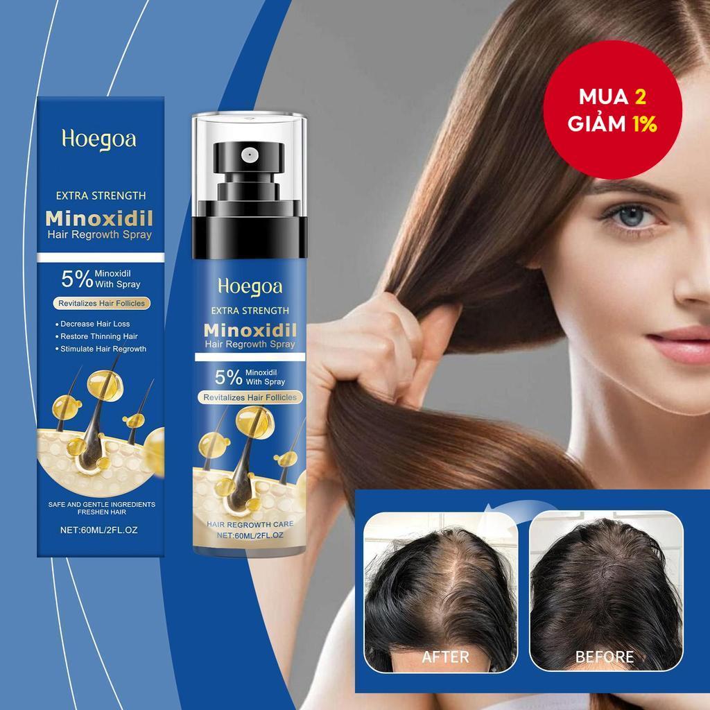5% Minoxidil giúp mọc tóc, dầu xịt mọc tóc, xịt Minoxidil với huyết thanh hương thảo rụng tóc cho tó