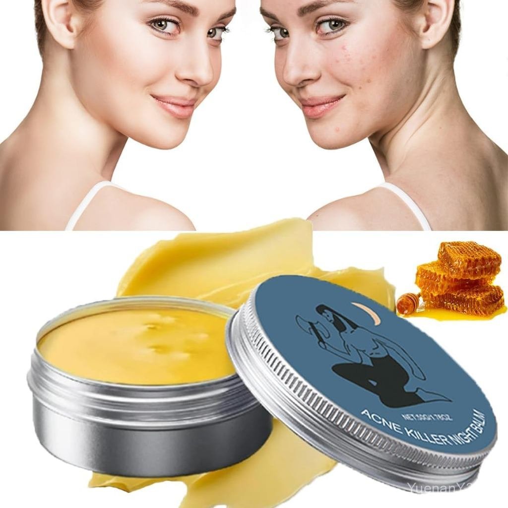 N-orse A-cne O-rganics Balm Cream, N-orse O-rganics A-cne Balm, Organics Acne Killer, Norse Organics